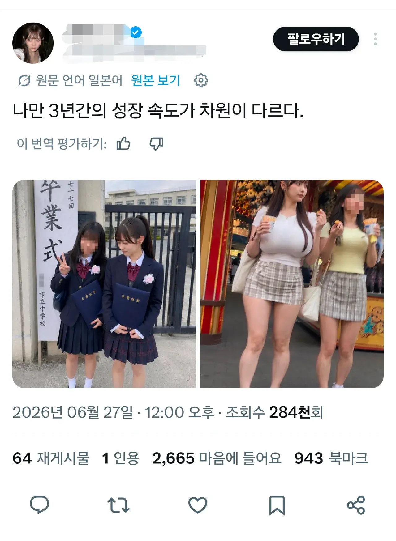 본인만 성장속도가 다르다는 일본인